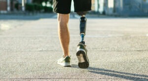 Low angle view at disabled young man with prosthetic leg walking along the street